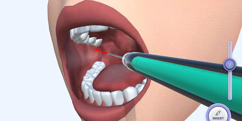 牙医模拟中文版